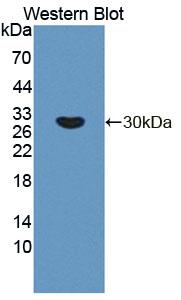 Used in DAB staining on fromalin fixed paraffin- embedded liver tissue