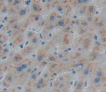 Peroxisomal D3, D2-Enoyl Coenzyme A Isomerase (PECI) Polyclonal Antibody - image 4