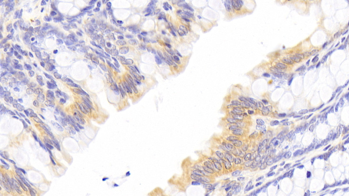 3-Hydroxy-3-Methylglutaryl Coenzyme A Reductase (HMGCR) Polyclonal Antibody - image 4