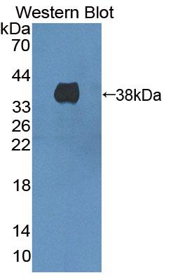 Western Blot; Sample: Lane1: Mouse Liver lysate; Lane2: Mouse Brain lysate; Primary Ab: 1µg/mL Rabbit Anti-Mouse HMGCL Antibody; Second Ab: 0.2µg/mL HRP-Linked Caprine Anti-Rabbit IgG Polyclonal Antibody;