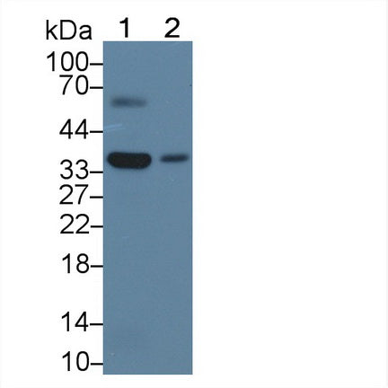 Used in DAB staining on fromalin fixed paraffin- embedded liver tissue