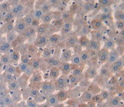 3-Hydroxymethyl-3-Methylglutaryl Coenzyme A Lyase (HMGCL) Polyclonal Antibody - image 4