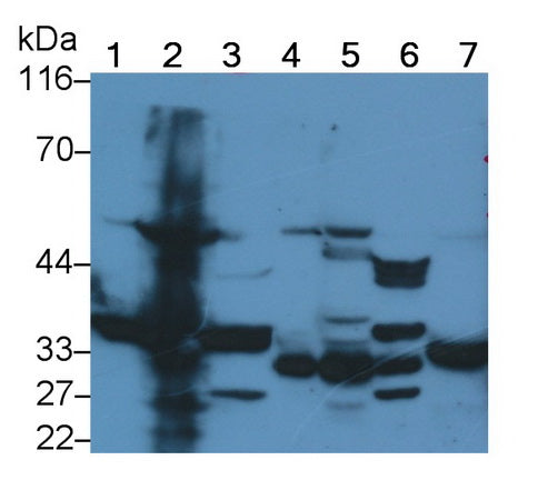 Used in DAB staining on fromalin fixed paraffin- embedded liver tissue