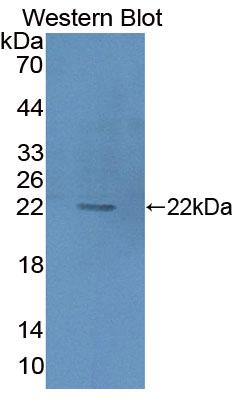 Used in DAB staining on fromalin fixed paraffin- embedded kidney tissue