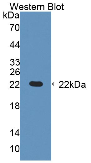 DAB staining on IHC-P; Samples: Mouse Liver Tissue;  Primary Ab: 20µg/ml Rabbit Anti-Mouse GCDH Anti