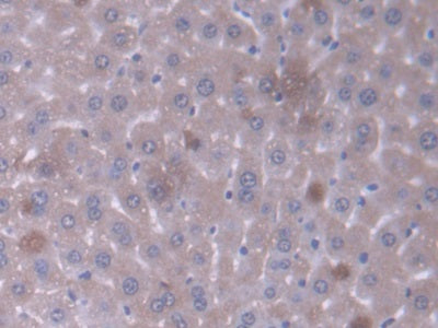 Glutaryl Coenzyme A Dehydrogenase (GCDH) Polyclonal Antibody - image 5