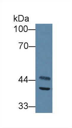 Western Blot; Sample: Recombinant protein.