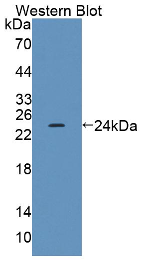 DAB staining on IHC-P; Samples: Mouse Kidney Tissue; Primary Ab: 20µg/ml Rabbit Anti-Mouse ACADS Antibody Second Ab: 2µg/mL HRP-Linked Caprine Anti-Rabbit IgG Polyclonal Antibody