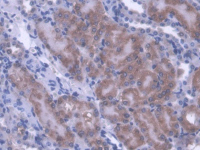 DAB staining on fromalin fixed paraffin- embedded kidney tissue)