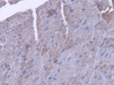 Acyl Coenzyme A Dehydrogenase, C2-To-C3 Short Chain (ACADS) Polyclonal Antibody - image 5
