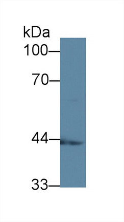 Western Blot; Sample: Recombinant protein.