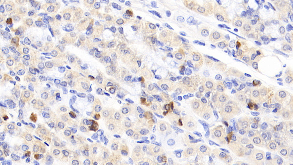 DAB staining on fromalin fixed paraffin- embedded liver tissue)