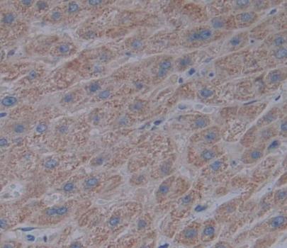 Acyl Coenzyme A Dehydrogenase, Long Chain (ACADL) Polyclonal Antibody - image 4