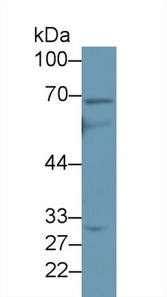 Western Blot; Sample: Recombinant protein.