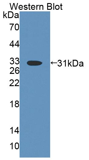 DAB staining on IHC-P; Samples: Human Kidney Tissue;  Primary Ab: 20µg/ml Rabbit Anti-Human ABCD4 An