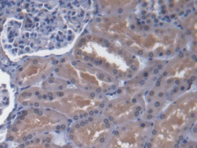 ATP Binding Cassette Transporter D4 (ABCD4) Polyclonal Antibody - image 5