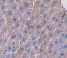 ATP Binding Cassette Transporter A13 (ABCA13) Polyclonal Antibody - image 3