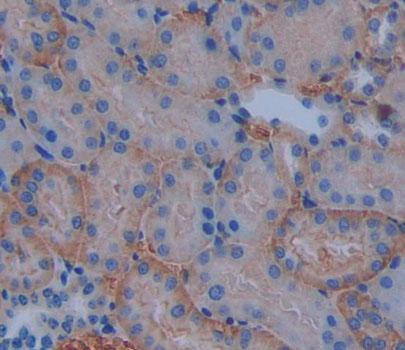 ATP Binding Cassette Transporter B10 (ABCB10) Polyclonal Antibody - image 3