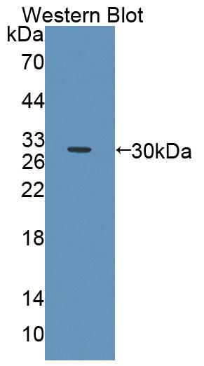 ATP Binding Cassette Transporter A2 (ABCA2) Polyclonal Antibody - image 2