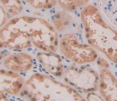ATP Binding Cassette Transporter A2 (ABCA2) Polyclonal Antibody - image 3