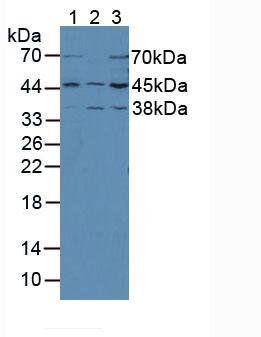 Western Blot; Sample: Lane1: Rat Cerebrum lysate; Lane2: Porcine Cerebrum lysate; Lane3: Hela cell lysate; Lane4: MCF7 cell lysate; Primary Ab: 2µg/ml Rabbit Anti-Mouse MAP2K2 Antibody; Second Ab: 0.2µg/mL HRP-Linked Caprine Anti-Rabbit IgG Polyclonal Antibody;