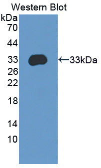 Amyloid Beta Precursor Protein Binding Protein A3 (APBA3) Polyclonal Antibody - image 2