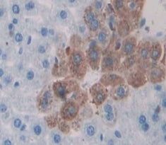 Amyloid Beta Precursor Protein Binding Protein A3 (APBA3) Polyclonal Antibody - image 3