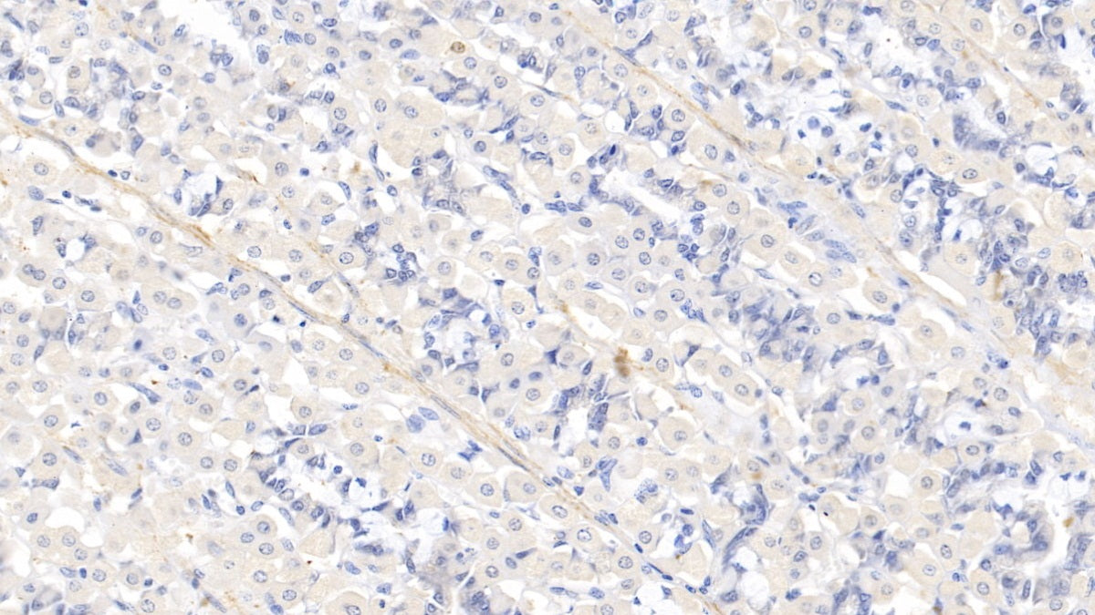 Myosin Heavy Chain 11, Smooth Muscle (MYH11) Polyclonal Antibody - image 4