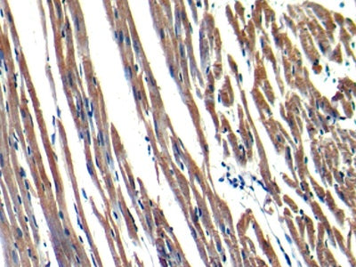 DAB staining on IHC-P; Samples: Rat Heart Tissue)