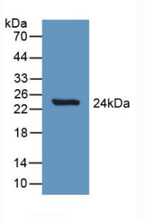 DAB staining on IHC-P; Samples: Rat Heart Tissue; Primary Ab: 30µg/ml Rabbit Anti-Rat Slit1 Antibody Second Ab: 2µg/mL HRP-Linked Caprine Anti-Rabbit IgG Polyclonal Antibody