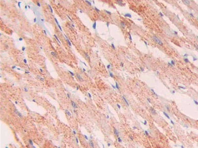 DAB staining on IHC-P; Samples: Rat Kidney Tissue.