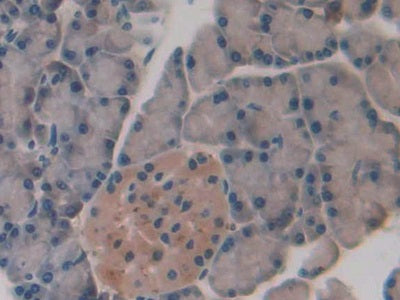 Slit Homolog 1 (Slit1) Polyclonal Antibody - image 4