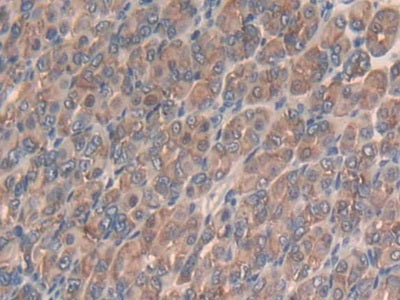 Slit Homolog 3 (Slit3) Polyclonal Antibody - image 4