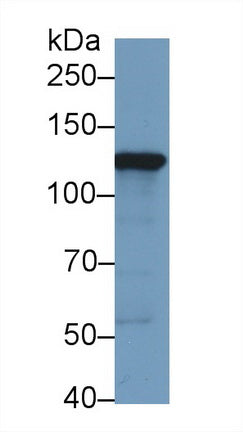 Western Blot; Sample: Recombinant protein.
