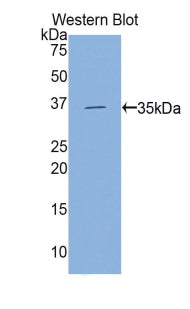 DAB staining on IHC-P; Samples: Human Cardiac Muscle Tissue;  Primary Ab: 20μg/ml Rabbit Anti-Human HK2 Antibody Second Ab: 2µg/mL HRP-Linked Caprine Anti-Rabbit IgG Polyclonal Antibody