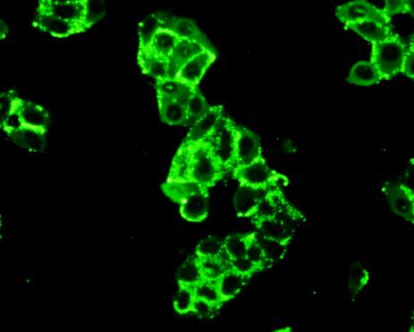 Hexokinase 2 (HK2) Polyclonal Antibody - image 5