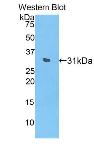 Interleukin 17 Receptor D (IL17RD) Polyclonal Antibody - image 2