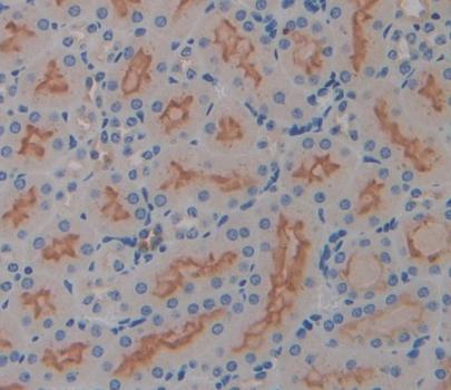 Interleukin 17 Receptor D (IL17RD) Polyclonal Antibody - image 3