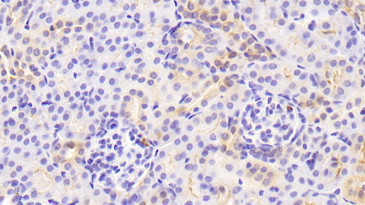 Amiloride Sensitive Sodium Channel Subunit Alpha (SCNN1a) Polyclonal Antibody - image 3