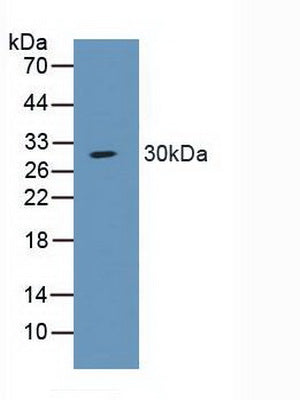 Western Blot; Sample: Recombinant SCNN1a, Human.