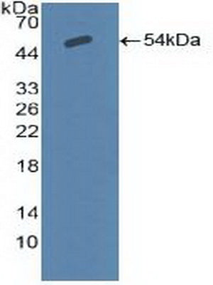 DAB staining on IHC-P; Samples: Human Kidney Tissue;  Primary Ab: 20μg/ml Rabbit Anti-Human SCNN1a Antibody Second Ab: 2µg/mL HRP-Linked Caprine Anti-Rabbit IgG Polyclonal Antibody