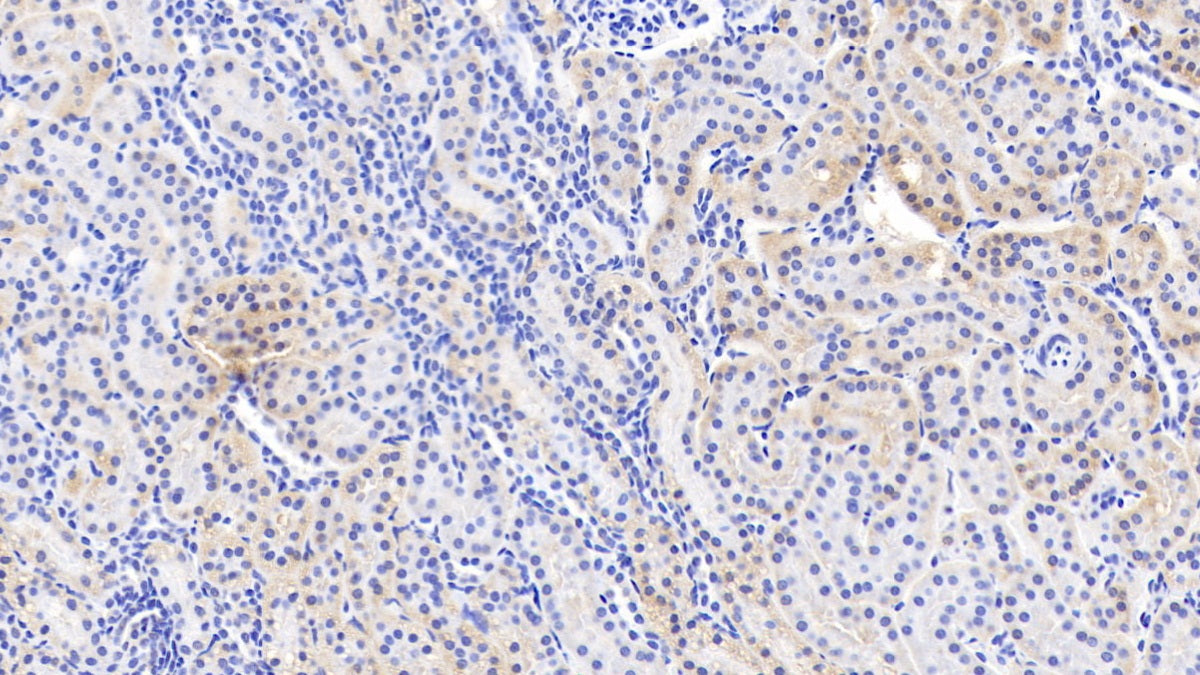 Amiloride Sensitive Sodium Channel Subunit Alpha (SCNN1a) Polyclonal Antibody - image 4