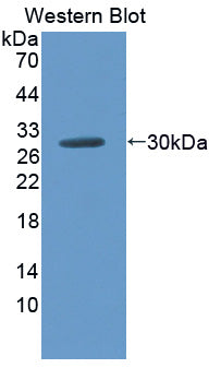 Amiloride Sensitive Sodium Channel Subunit Gamma (SCNN1g) Polyclonal Antibody - image 2