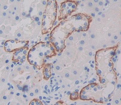 Amiloride Sensitive Sodium Channel Subunit Gamma (SCNN1g) Polyclonal Antibody - image 3