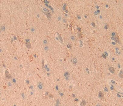 Aldolase C, Fructose Bisphosphate (ALDOC) Polyclonal Antibody - image 3