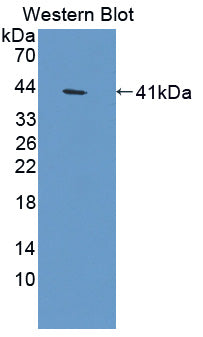 Aldolase B, Fructose Bisphosphate (ALDOB) Polyclonal Antibody - image 2