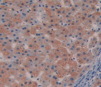 Aldolase B, Fructose Bisphosphate (ALDOB) Polyclonal Antibody - image 3