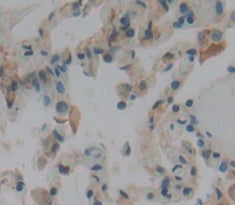 Calmodulin 1 (CALM1) Polyclonal Antibody - image 3