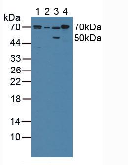 Western Blot; Sample: Recombinant CPR, Human.