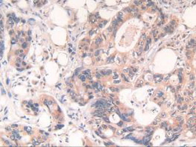 Cytochrome P450 Reductase (CPR) Polyclonal Antibody - image 5